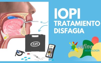 Sistema IOPI Medical – Tratamiento de la Disfagia