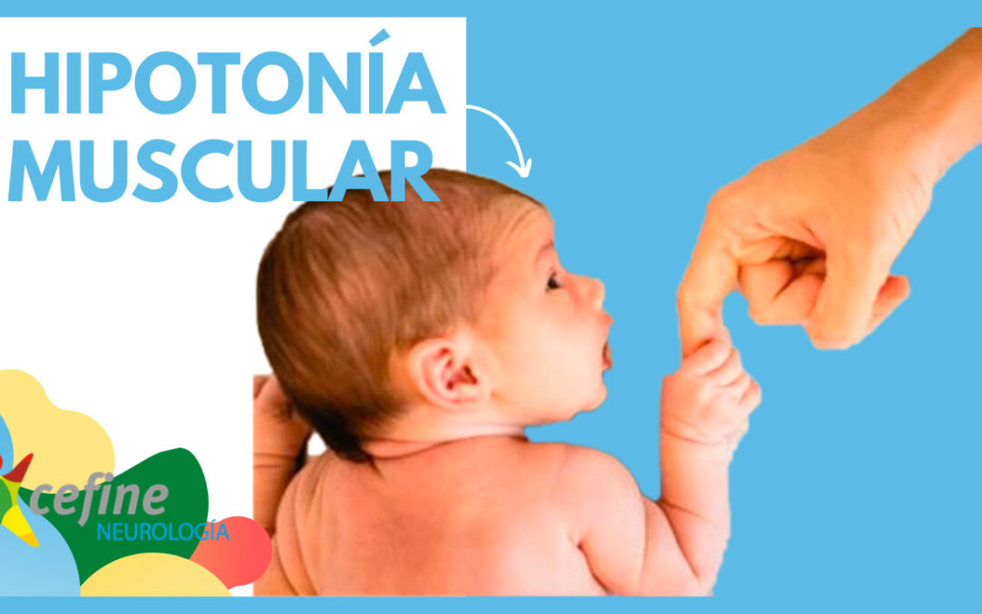 Hipotonía muscular en bebés – Qué es, cómo se detecta y qué tratamiento seguir.